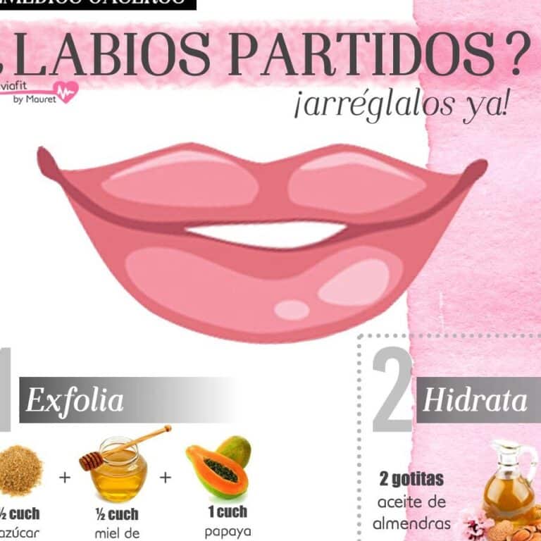 Remedios Caseros Para Labios Partidos Y Secos Remedios Caseros